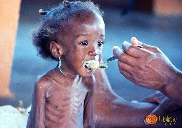 В Африке голодают дети